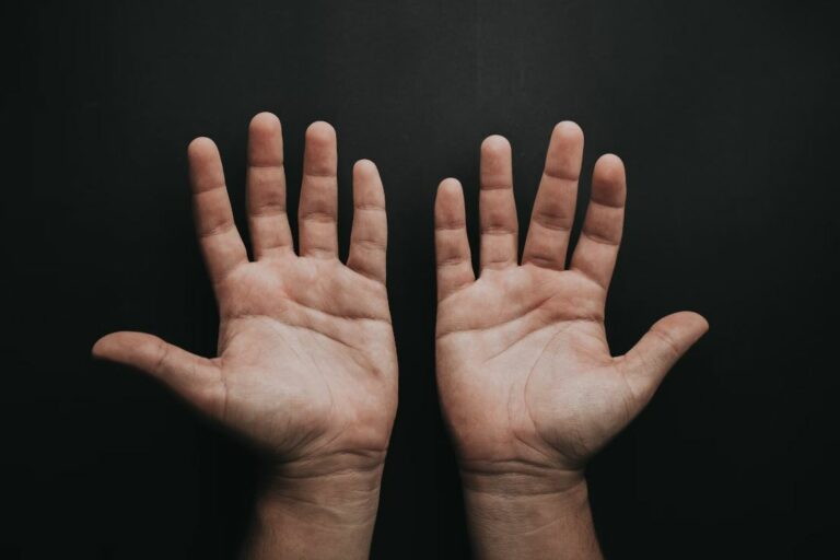 Can-Anxiety-Cause-Sweaty-Palms